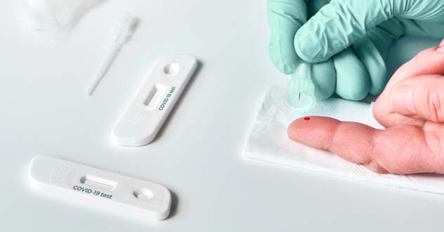 Москвичи могут бесплатно пройти экспресс-тестирование на коронавирус