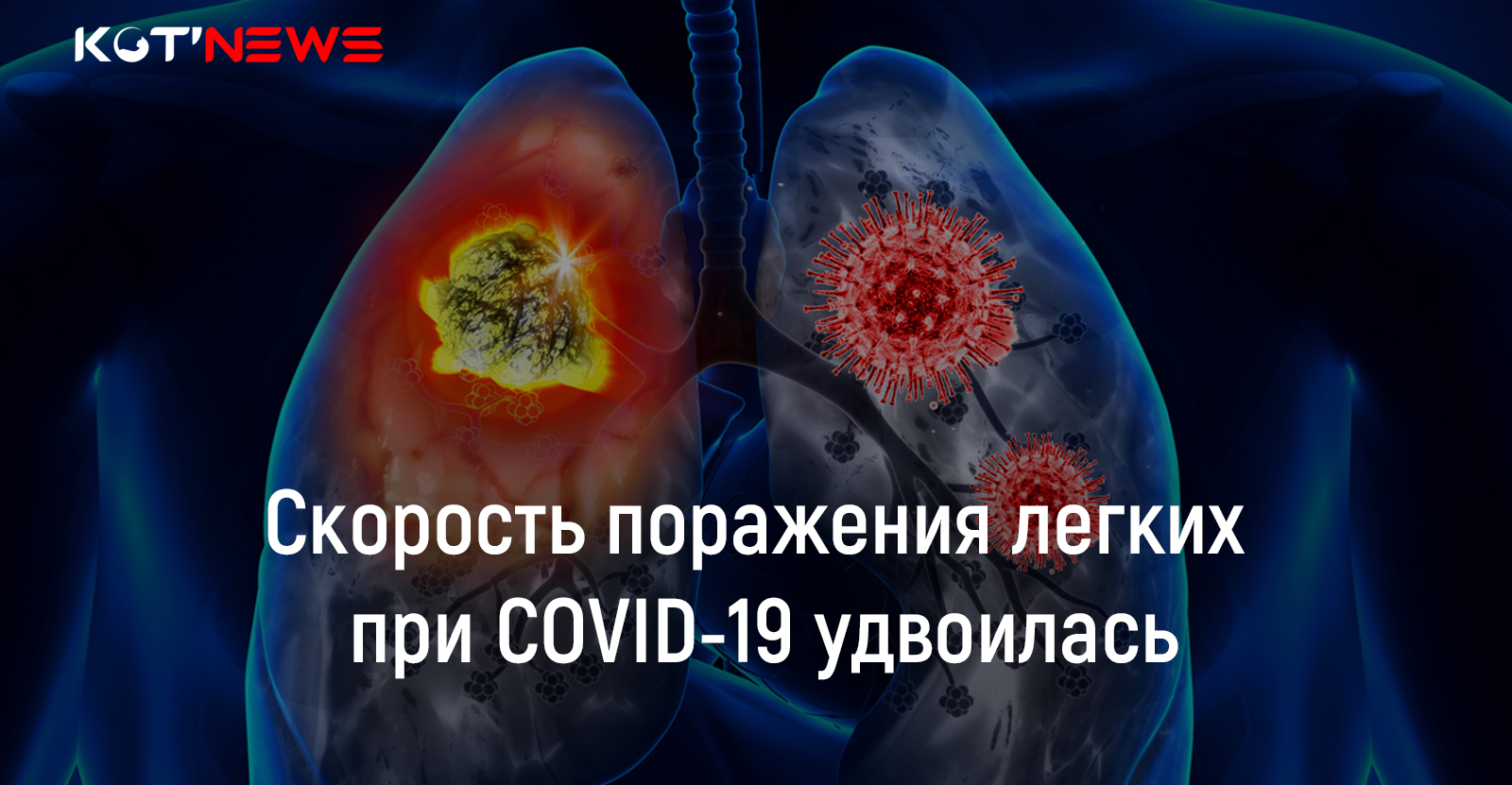 Скорость поражения легких при COVID-19 удвоилась